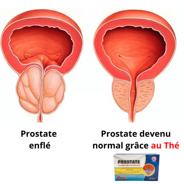 Granulés Prostate Long Hai –