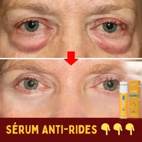 Sérum à la Lutéine – Soin Intensif & Protection Visuelle